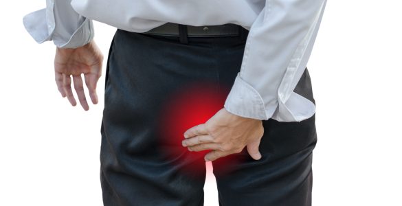 comment savoir prolapsus anal
